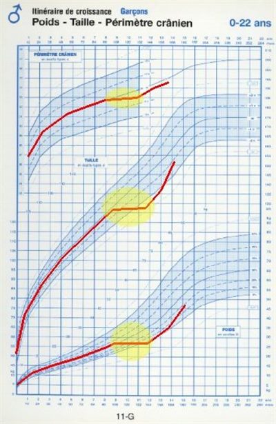 Troubles de la croissance