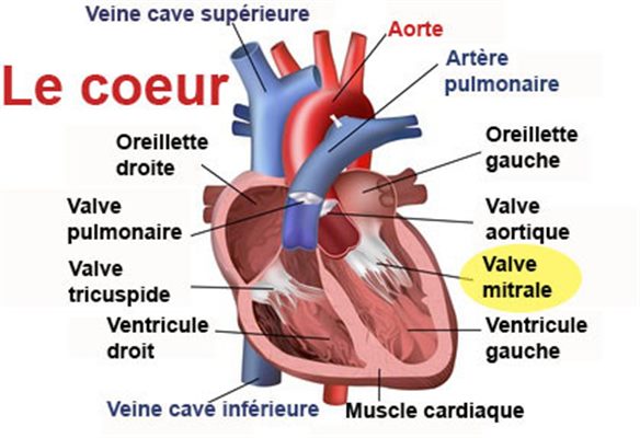 Rétrécissement mitral