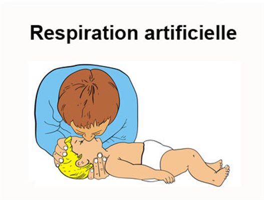 Ventilation assistée chez un nourrisson