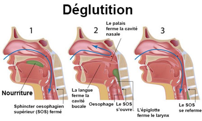 Troubles de la déglutition