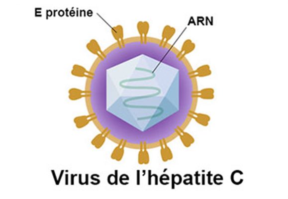 Hépatite C : témoignage de patient