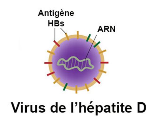 Hépatite chronique