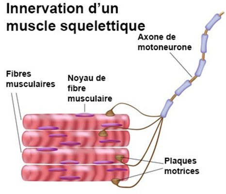 Myasthénie