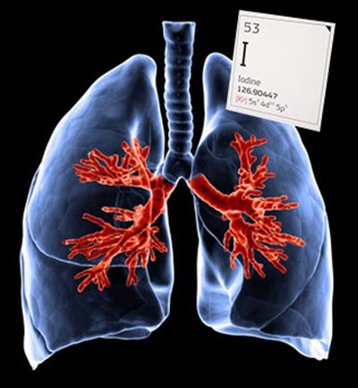 Bronchographie lipiodolée