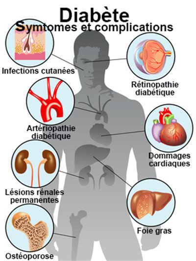 Complications chroniques du diabète