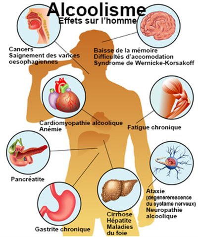 Alcool: les points clés