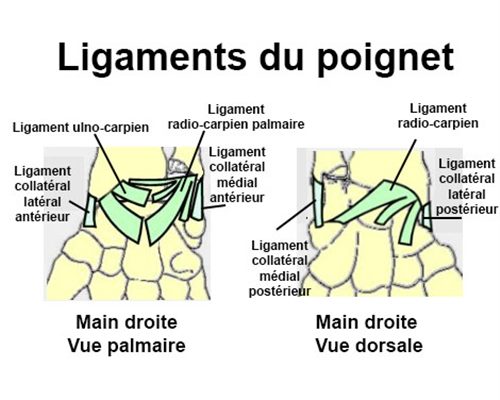 Entorse du poignet